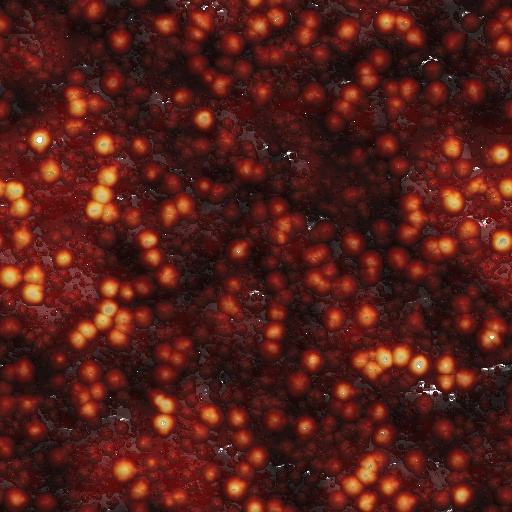 Ne56 Disease (Texture)