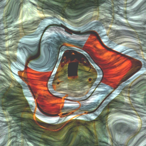Variation 3