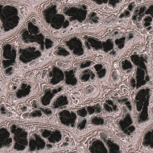 Variation 1