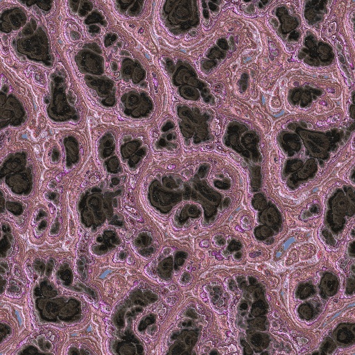 Variation 6