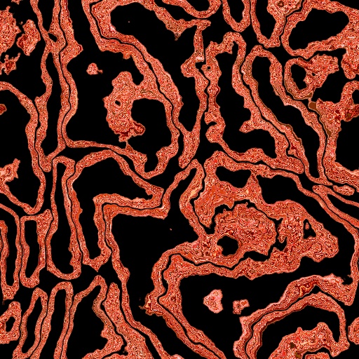 Variation 2