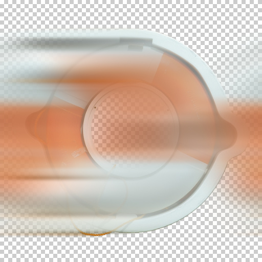 Variation 3