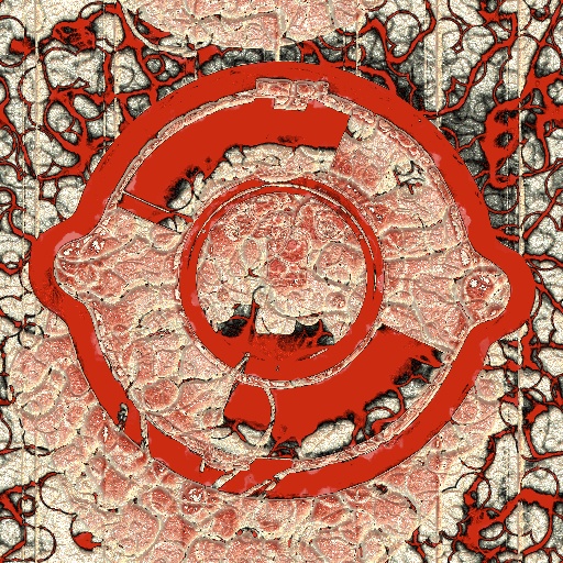 Variation 1