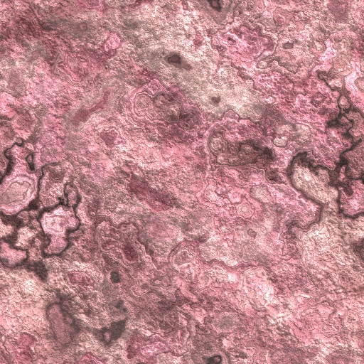 Variation 4