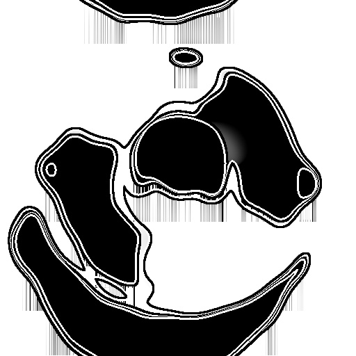 Variation 5