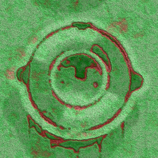 Variation 3
