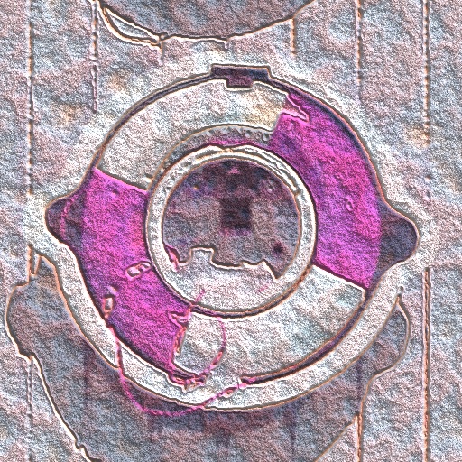 Variation 5