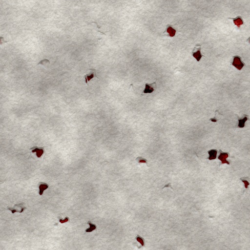 Variation 3