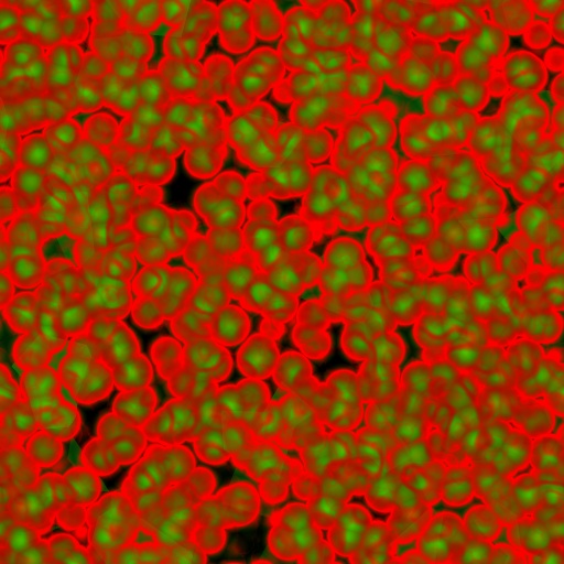 Variation 1