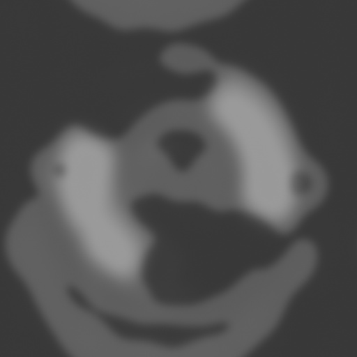 Bump Map