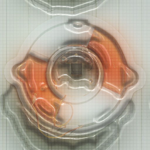 Variation 2