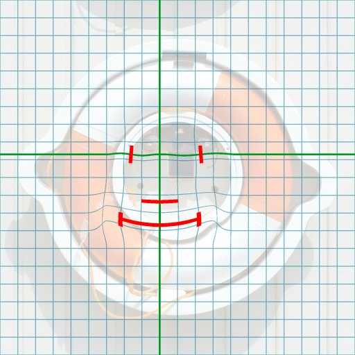 Variation 1