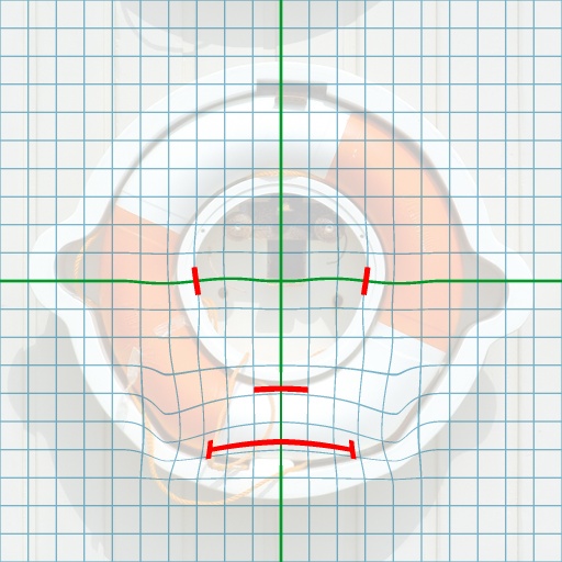 Variation 2