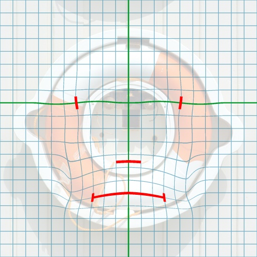 Variation 6