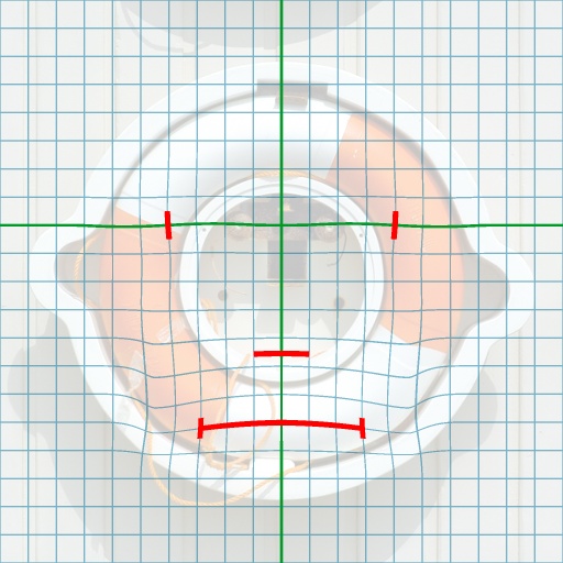 Variation 7