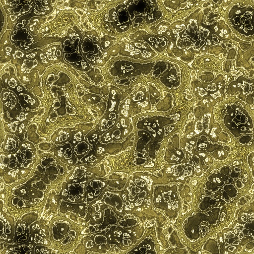 Variation 4