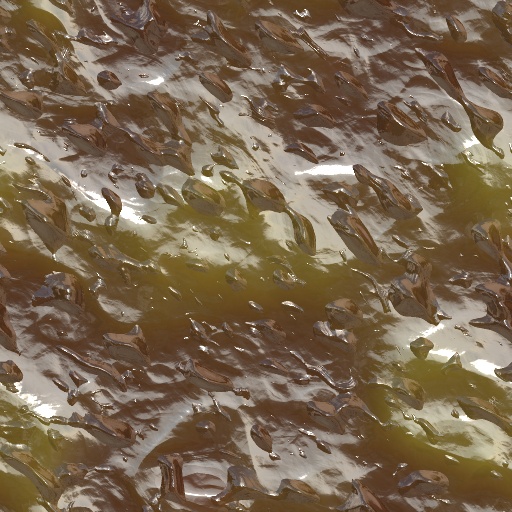calcul renaux (Texture)