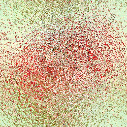 Variation 1