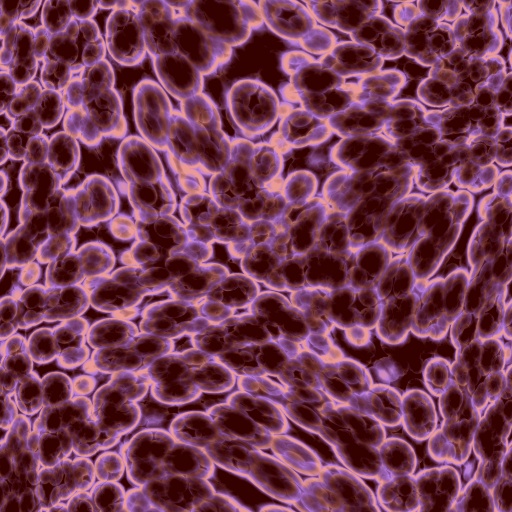 Variation 6