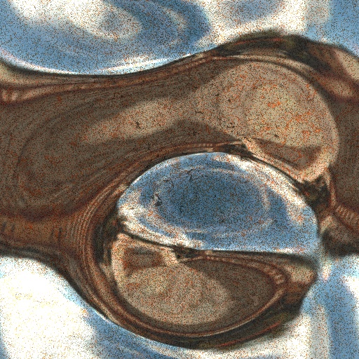 Variation 2
