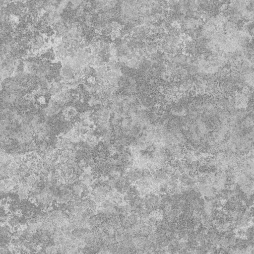 Bump Map