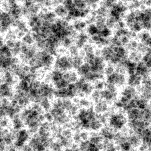 Bump Map