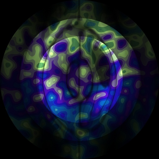 Variation 6