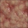 Veiny flesh
