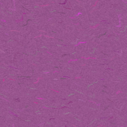 Variation 4