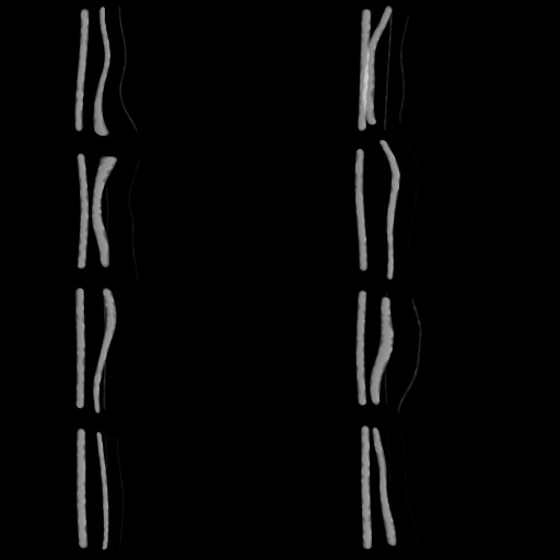 Variation 4