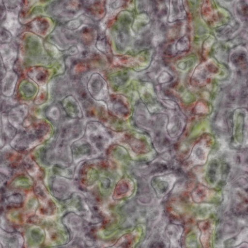 Variation 4
