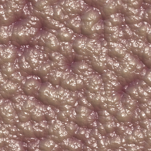 Variation 2