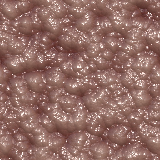 Variation 5