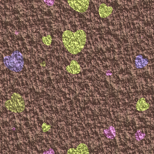 AL_Heart_Foil (Texture)