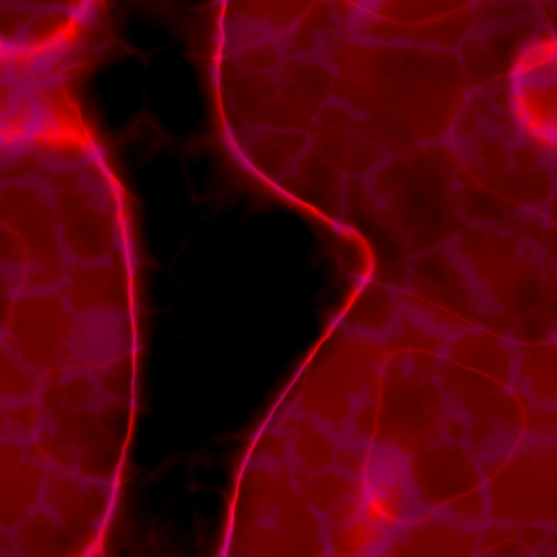 Variation 3