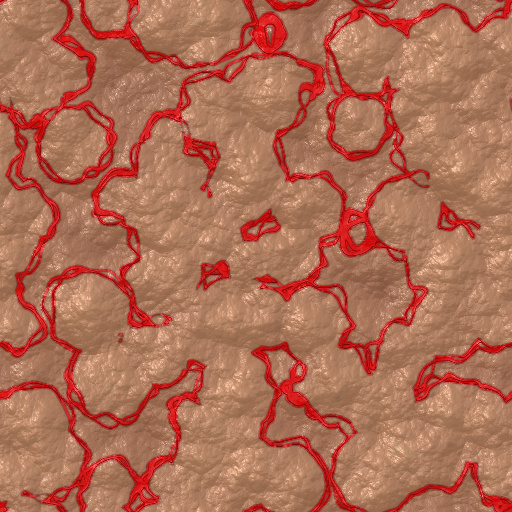 Variation 1