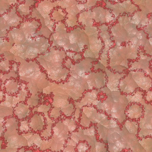 Variation 3