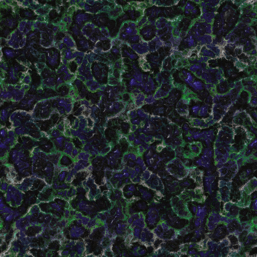Variation 7