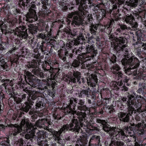 Variation 8